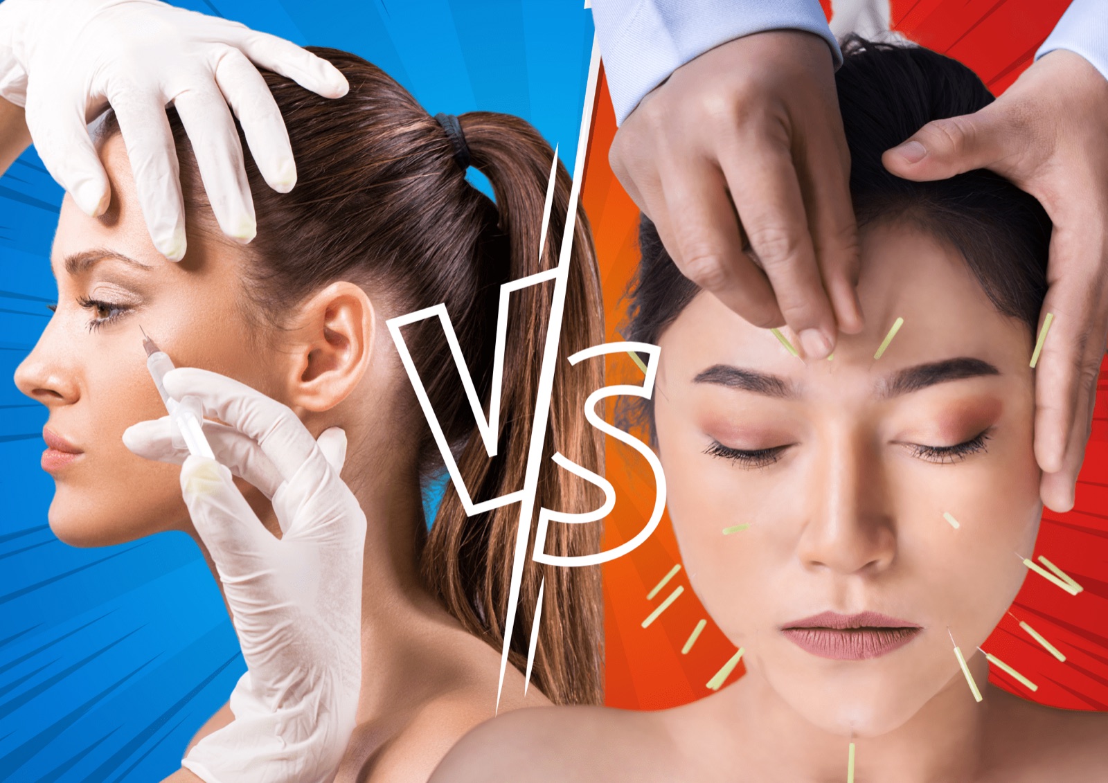 Facial Acupuncture vs. Botox - Which is Better?