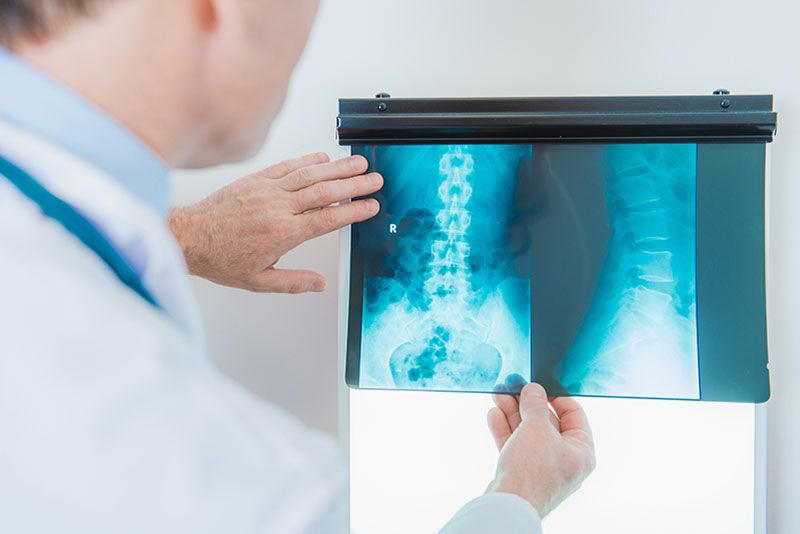 On-Site Digital X-Rays